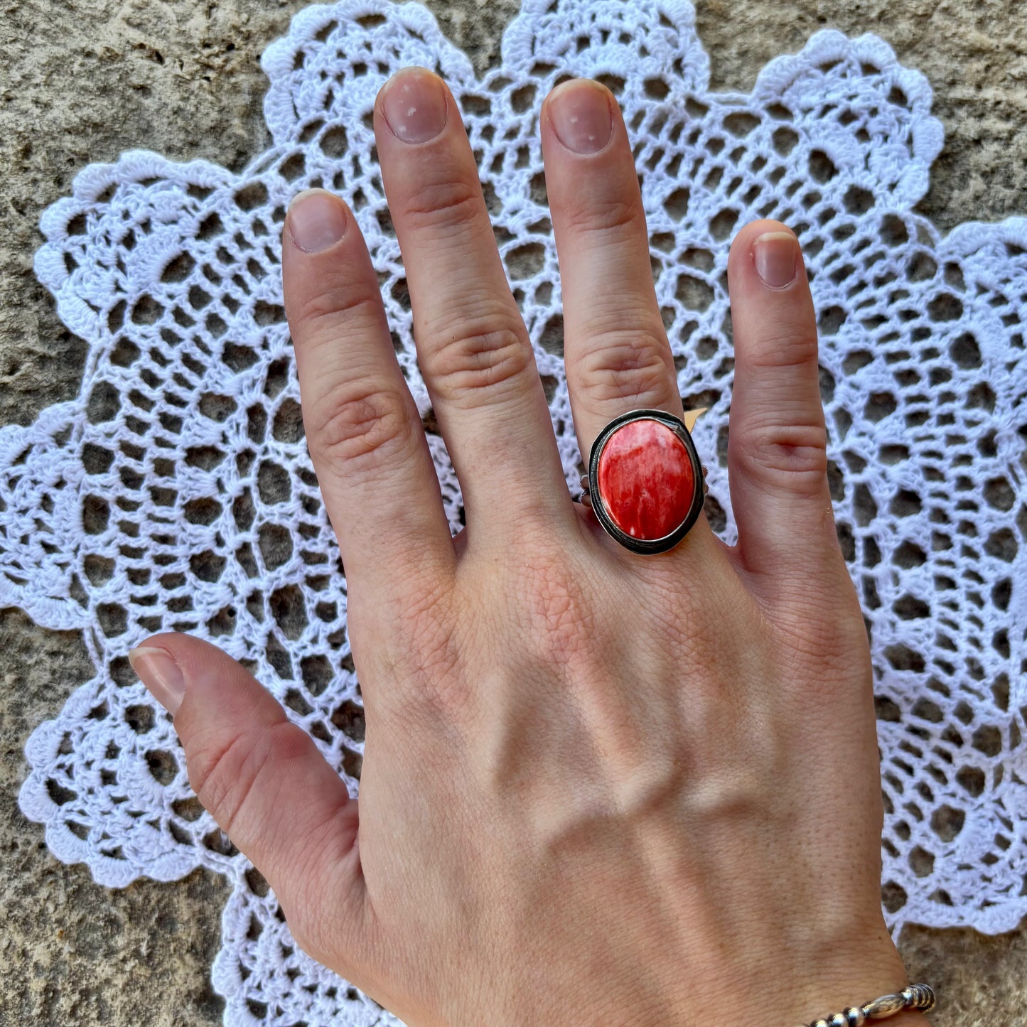 Red Spiny Ring - Size 7.5